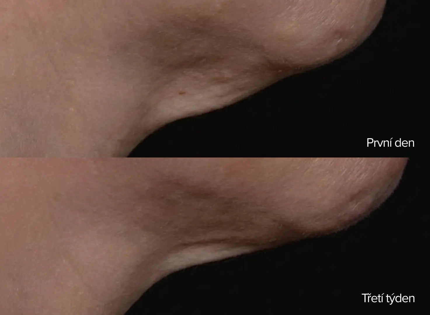 Densitium Bi-Serum dvoufázové omlazující sérum