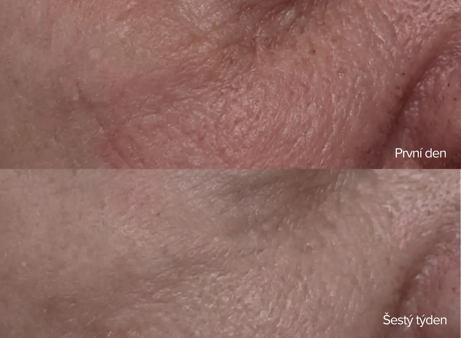 Densitium Bi-Serum dvoufázové omlazující sérum